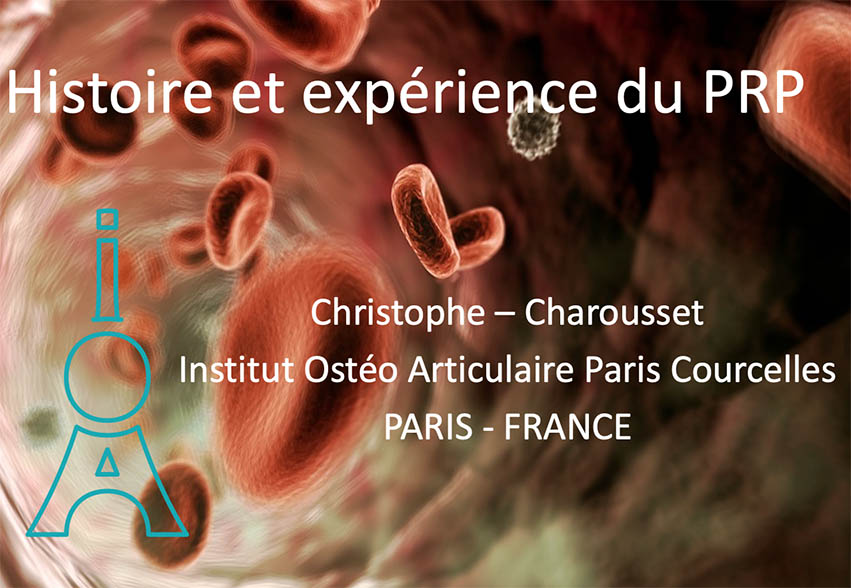 présentation sur les injections de PRP dans le traitement des arthroses et tendinites par le docteur christophe Charousset paris ioapc