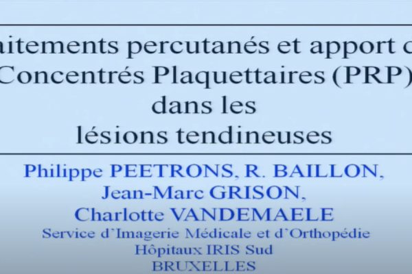 Intérêt de l'échographie dans les injections de PRP par le Pr Philippe Peetrons